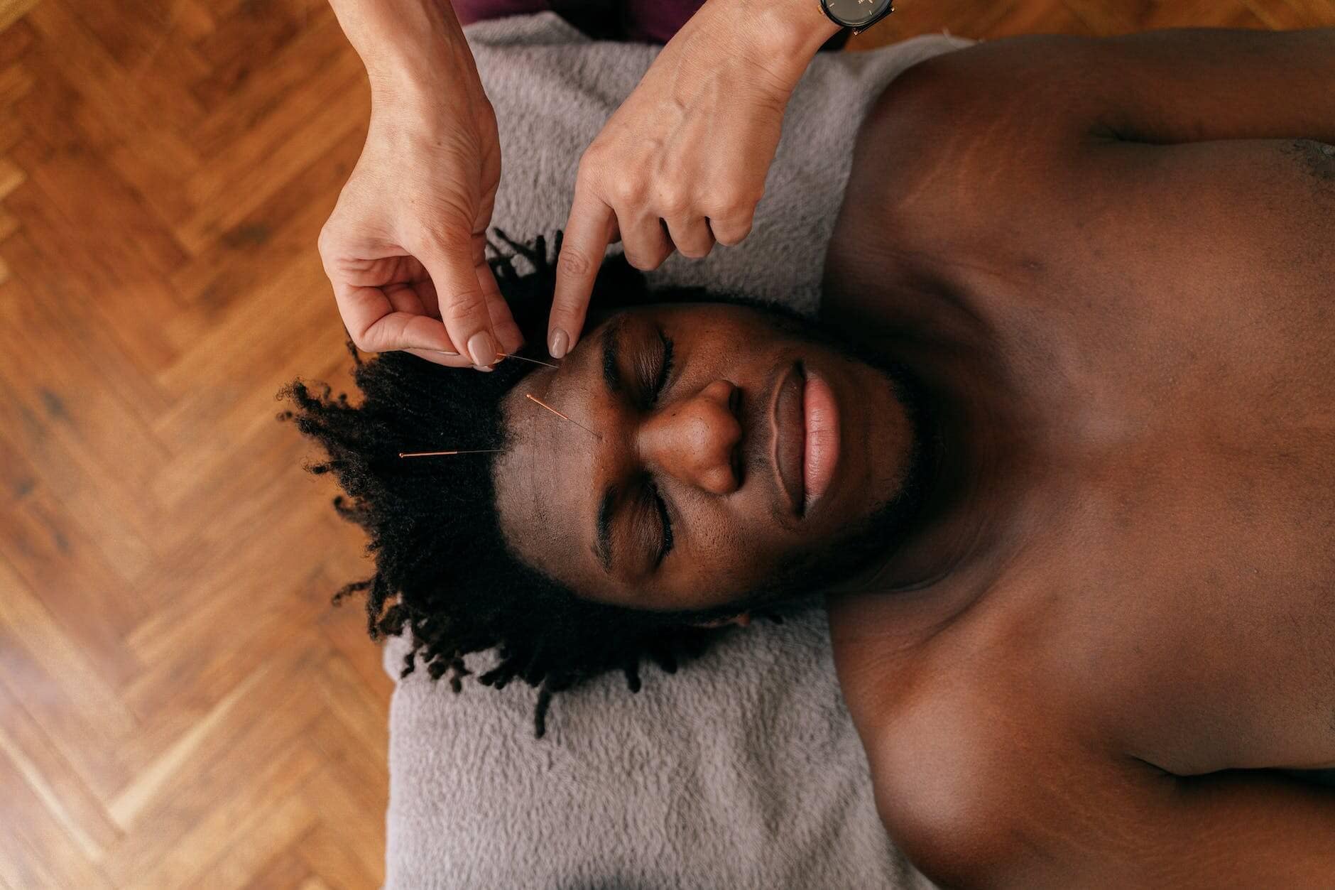 person putting needles on the forehead of a man